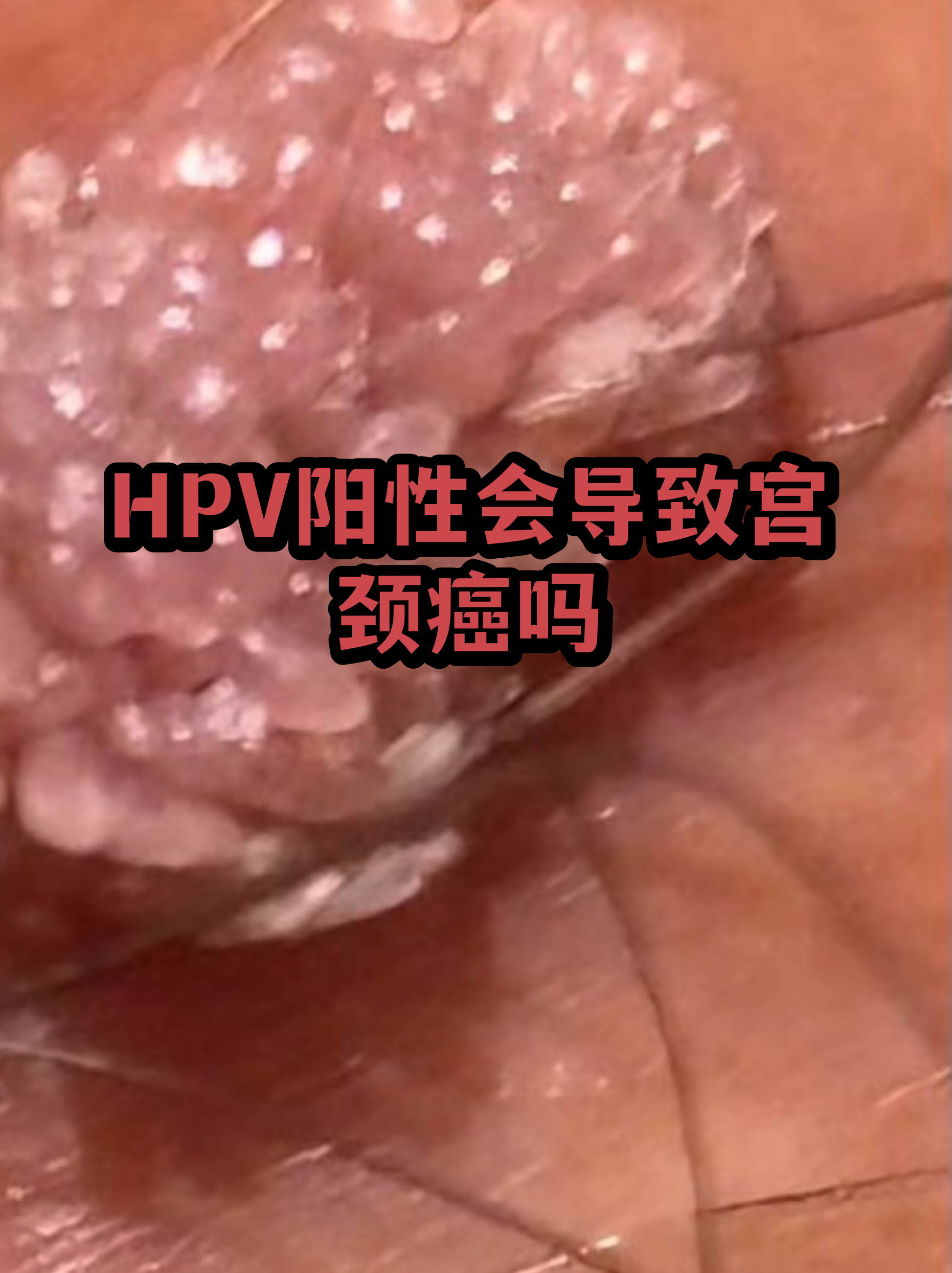 “保定:感染者确实不少” 保定3人感染病毒？-第2张图片