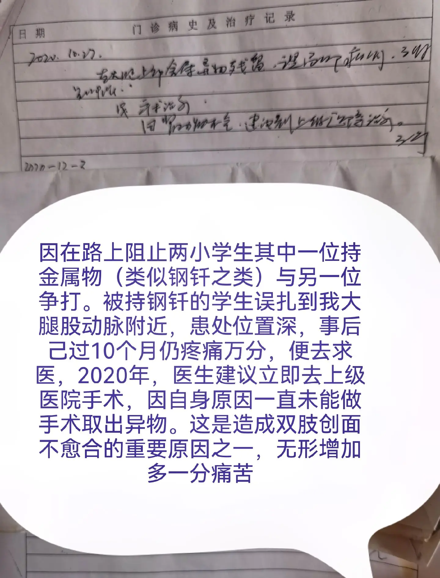 云南本土病例︰(云南本土病例有多少)-第1张图片