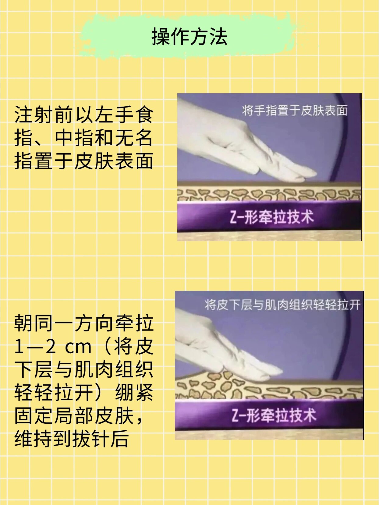 3分钟学会“闲逸碰胡可以开挂吗	”分享装挂详细步骤-第1张图片