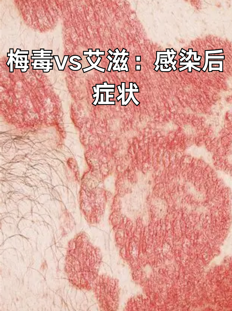 「感染进度」〃感染过程的五种表现形式-第1张图片